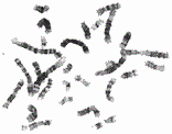 Biology Karyotype Worksheet Answers Key Best Of Karyotyping Activity