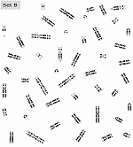 Biology Karyotype Worksheet Answers Key Unique Chromosome Study Teacher Instructions