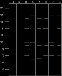 Dna Fingerprinting Worksheet Answers Fresh Dna Replication Questions1 Below is A Single Strand Of