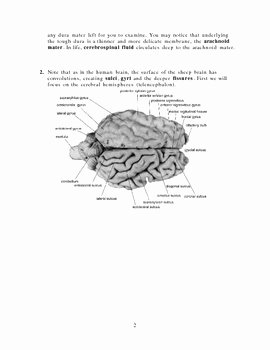 Sheep Brain Dissection Worksheet Unique External Sheep Brain Dissection Guide by Keith Metzger