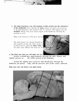 Sheep Brain Dissection Worksheet Unique Internal Sheep Brain Dissection Guide by Keith Metzger