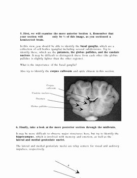 Sheep Brain Dissection Worksheet Unique Internal Sheep Brain Dissection Guide by Keith Metzger