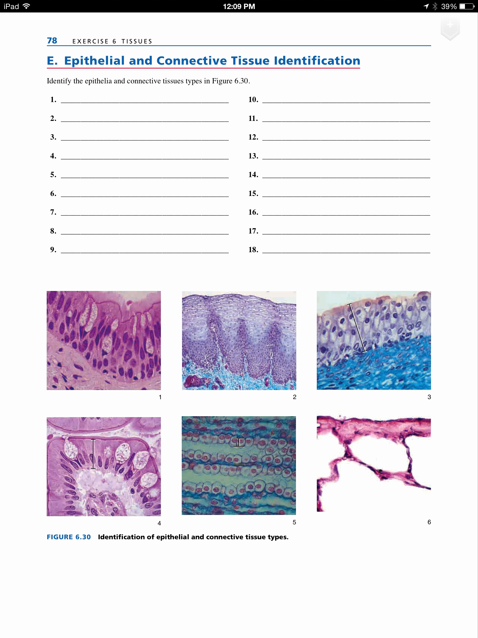 Types Of Tissues Worksheet New A Epithelial and Connective Tissue Identification